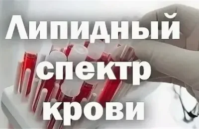 Липидный спектр – новый анализ в диспансеризации