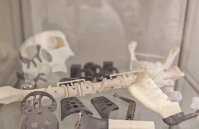 От снимка до изделия за 7 дней: новосибирские инноваторы разработали уникальные онкологические имплантаты